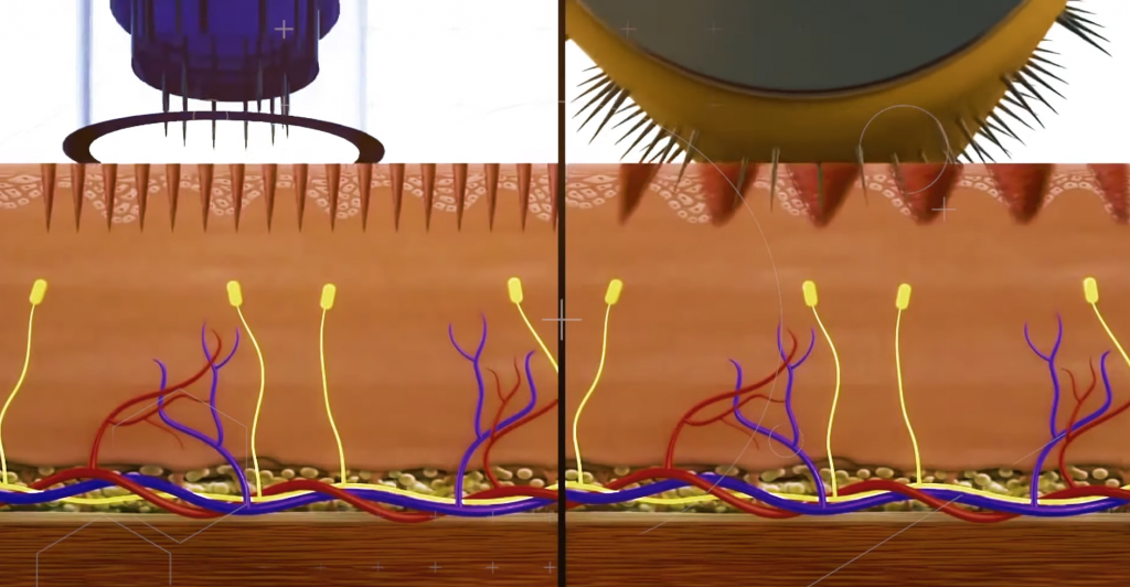 Derma Pen vs Derma Roller