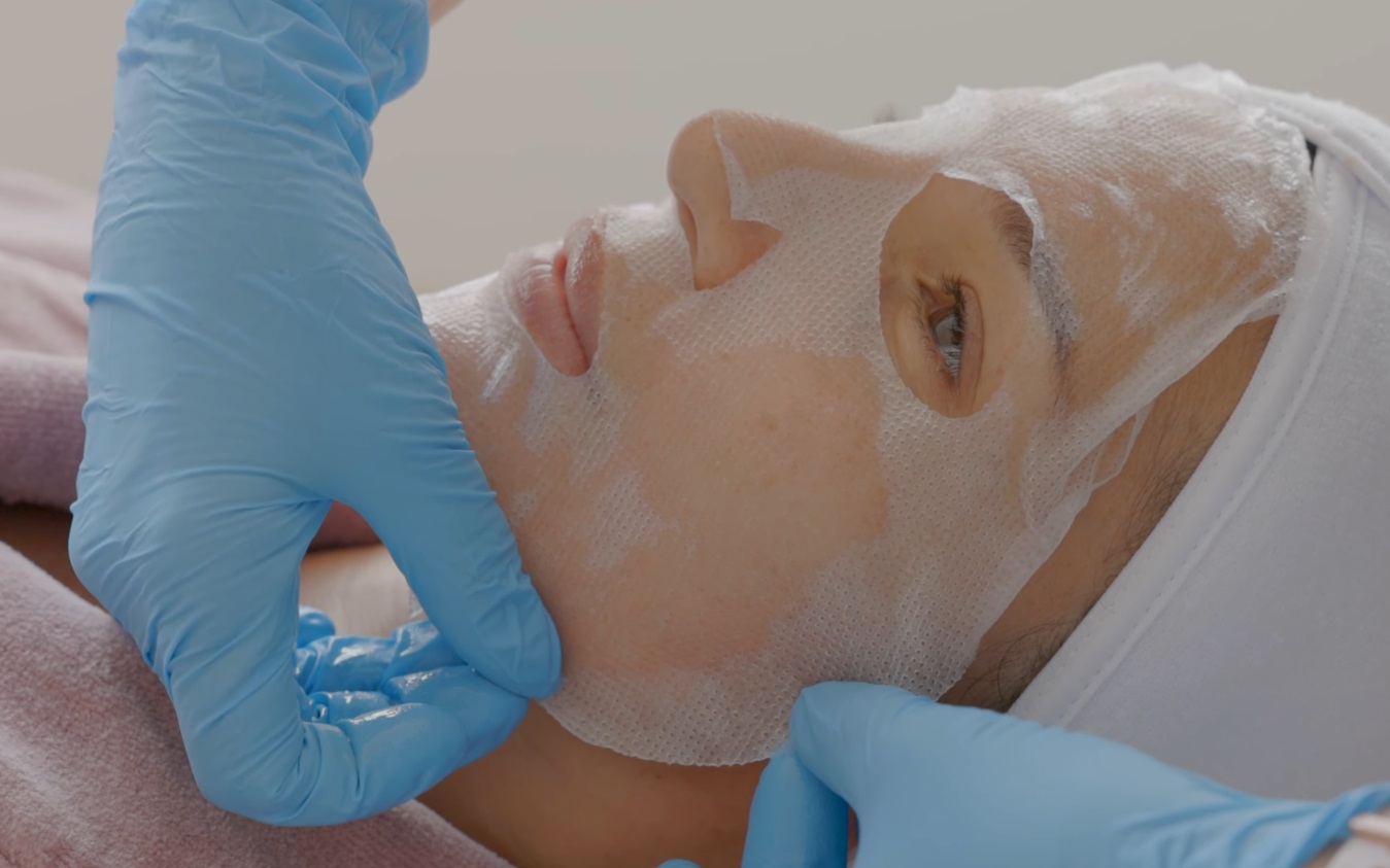 What Is Microneedling and How Can It Benefit Your Skin?